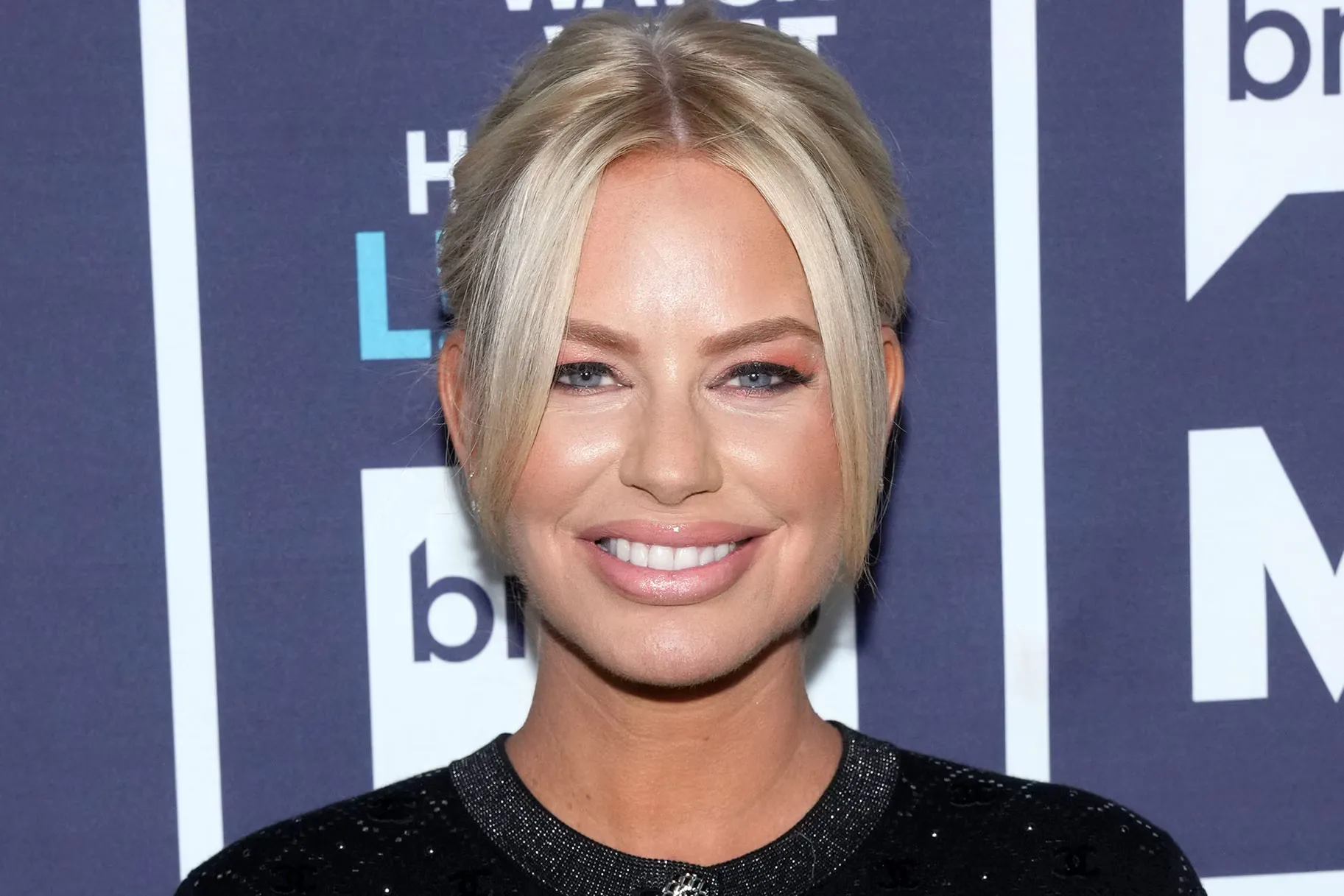 Caroline Stanbury Before and After Facelift