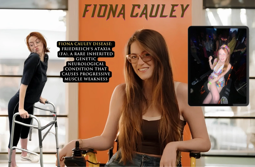 Fiona Cauley Disease: What She Has, Her Life Story & Comedy Career Fiona Cauley Disease: What She Has, Her Life Story & Comedy Career